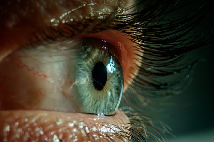 Photo shows close-up of a human eye