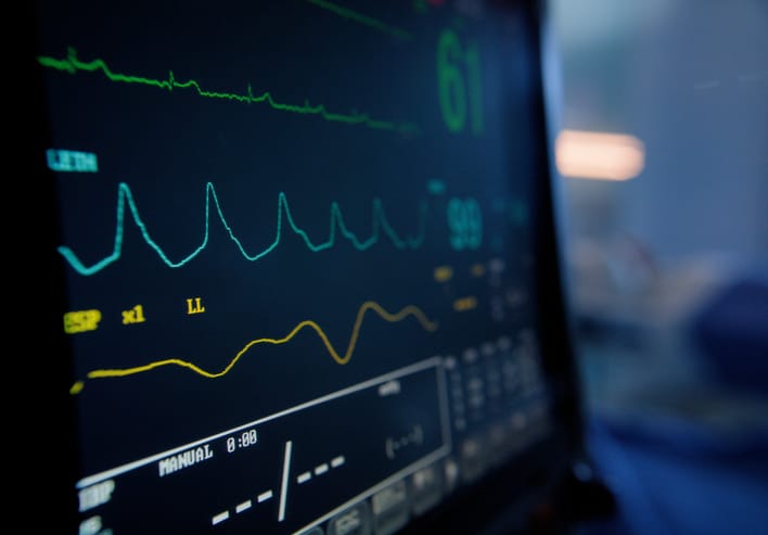 Photo shows vital signs monitor