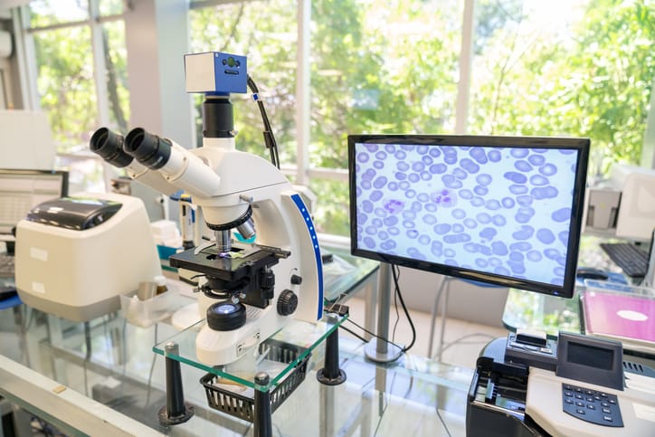 Monitor next to microscope showing bacteria in a biological research laboratory.